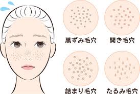 30代の毛穴の開きとたるみ